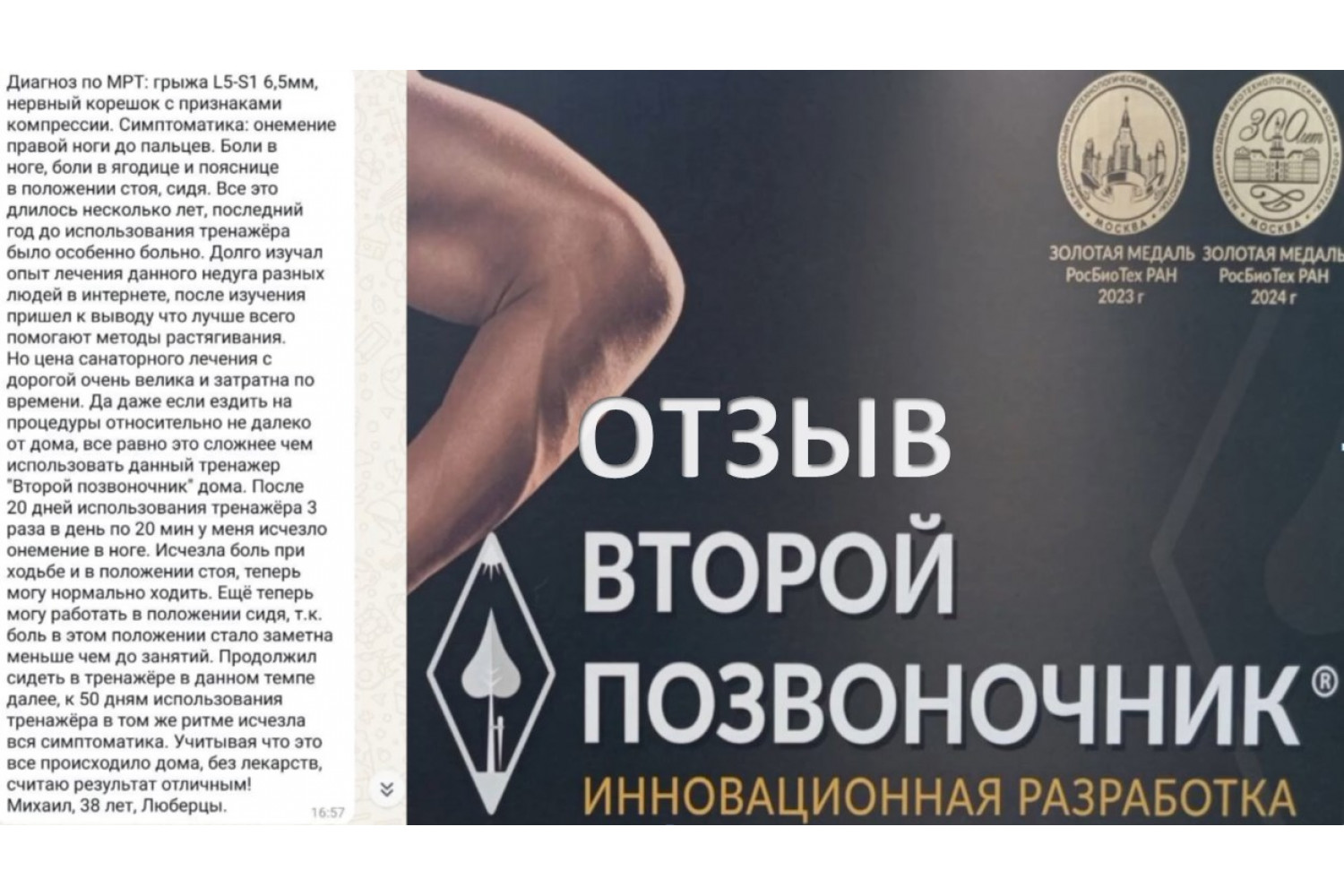 Михаил делится своим опытом лечения позвоночника по методу ОВ Челмакина «Второй позвоночник».